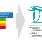 Les dangers de la lumière bleue sur nos yeux.